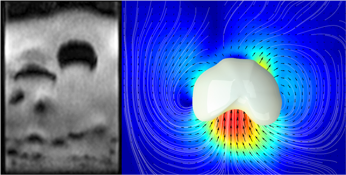 Enlarged view: Rapid imaging of granular dynamics