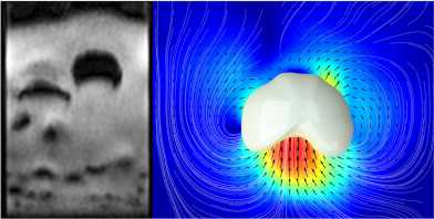 Rapid imaging of granular dynamics